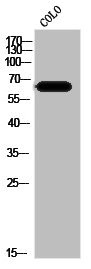 Anti-SLC39A4