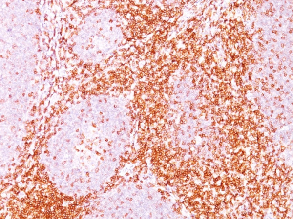 Anti-CD6, clone C6/372