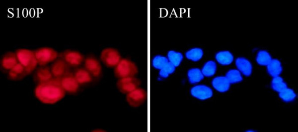 Anti-S100P, clone SQab1730