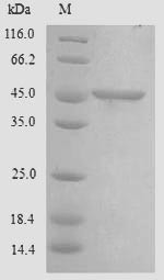 Chitinase domain-containing protein 1 (CHID1), human, recombinant