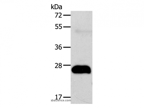 Anti-AGPAT2