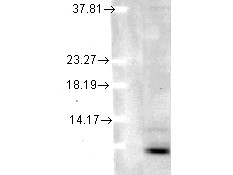 Anti-Ubiquitin, clone 5B9-B3