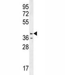 Anti-Caspase-12