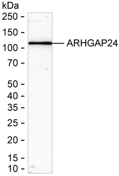 Anti-ARHGAP24