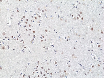 Anti-HDAC3 (recombinant antibody), clone RM439