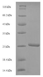 Scrapie-responsive protein 1 (SCRG1), human, recombinant