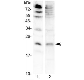 Anti-Keratinocyte Growth Factor / KGF (FGF7)