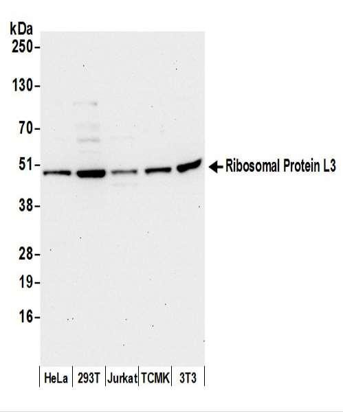 Anti-Ribosomal Protein L3/RPL3