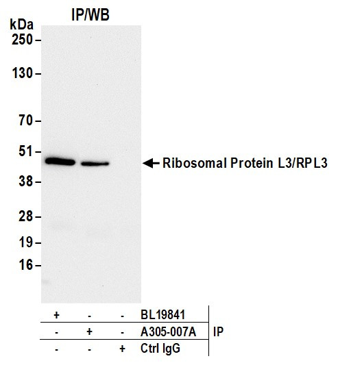 Anti-Ribosomal Protein L3/RPL3