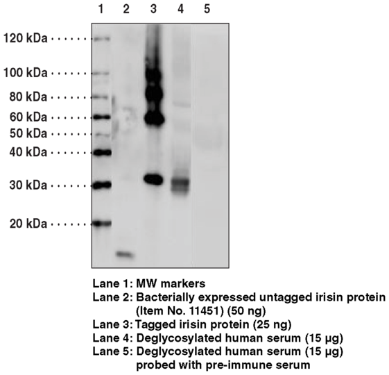 Anti-Irisin