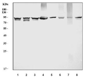 Anti-Prothrombin, clone 5B6G1
