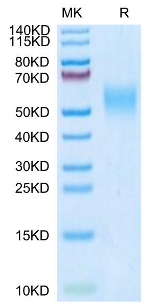 Mouse IL-2 R gamma/CD132 Protein
