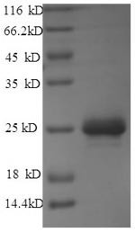Phosphinothricin N-acetyltransferase (bar), Streptomyces hygroscopicus, recombinant