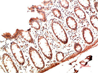 Anti-COL1A1 Monoclonal