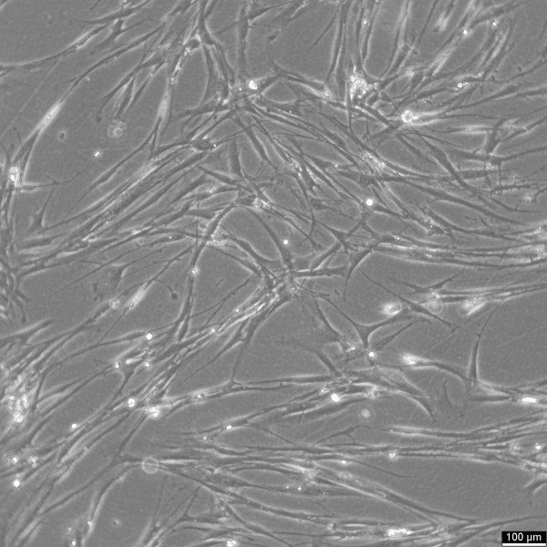 Wilms10M Cells