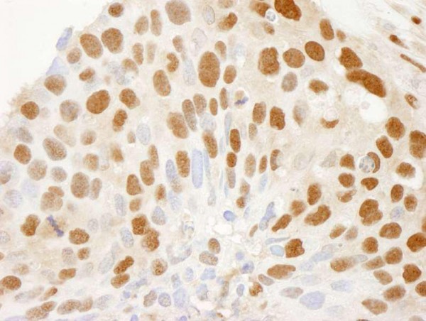 Anti-CRM1 (IHC)