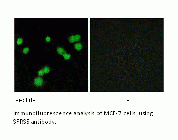 Anti-SFRS5