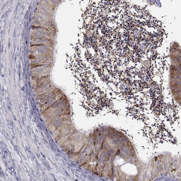 Anti-ROPN1B