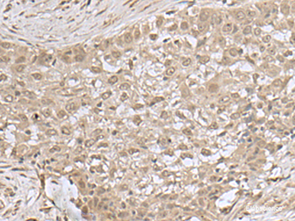 Anti-NEUROG3