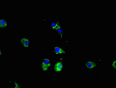 Anti-CPEB2