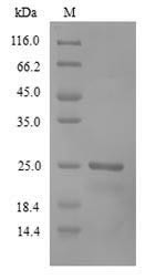 Recoverin (RCVRN), human, recombinant