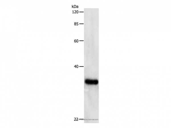 Anti-PCNA