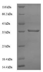 60S acidic ribosomal protein P0 (RPLP0), human, recombinant
