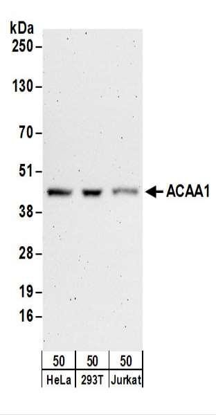 Anti-ACAA1