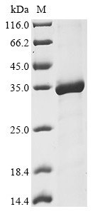 DNA repair protein RAD50 (RAD50), partial, human, recombinant