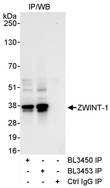 Anti-ZWINT-1