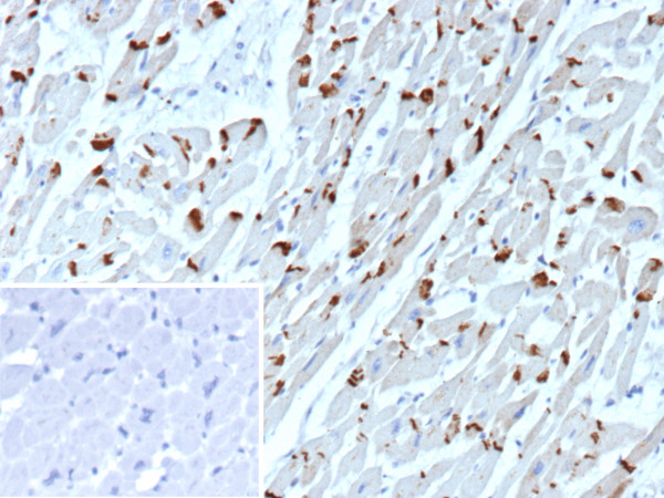 Anti-N-Cadherin / Cadherin-2 / CD325 (NCAD), clone CDH2/9491