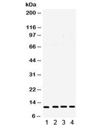 Anti-Cystatin B / CSTB / Stefin B