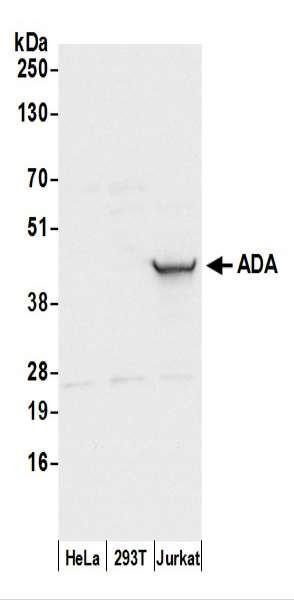 Anti-ADA/Adenosine Deaminase