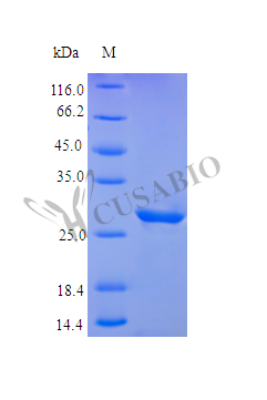 Insulin-like growth factor-binding protein 5 protein (IGFBP5) (Active), human, recombinant