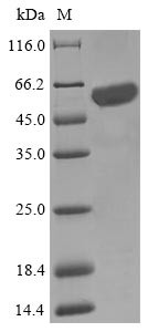 Cysteine desulfurase IscS (iscS), Escherichia coli O6:K15:H31, recombinant
