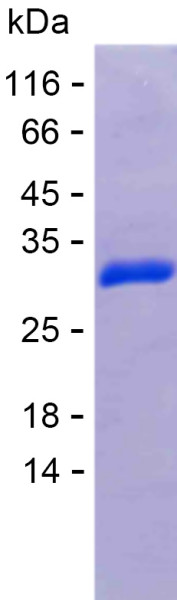 Recombinant Human RTL6 Protein