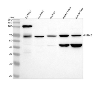 Anti-INSM2 / Insulinoma-associated protein 2