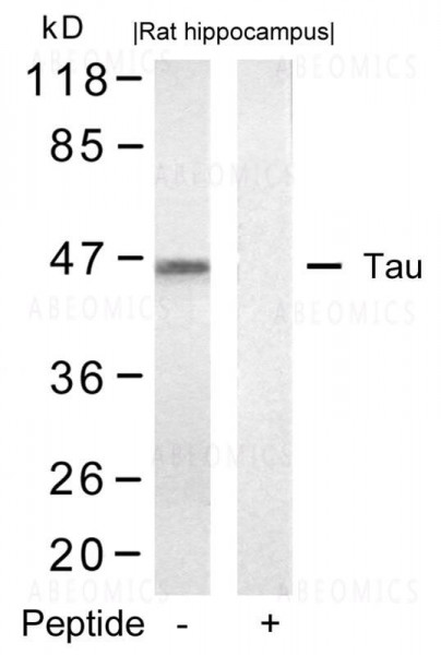 Anti-Tau (Ab-422)