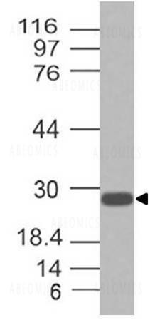 Anti-Troponin 1 (Clone: ABM5A65)