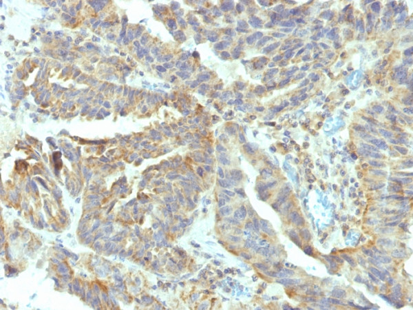 Anti-Alkaline Phosphatase (Tissue-Nonspecific), clone V17.1