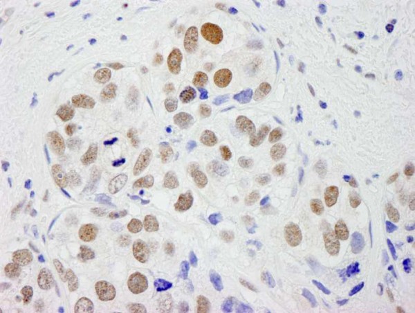 Anti-CPSF59 (IHC)