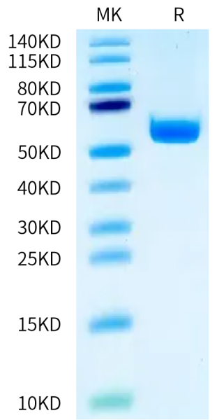 Human HLA-A*11:01&amp;B2M&amp;EGFR (KITDFGRAK) Monomer Protein