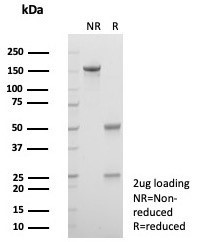 Anti-Alpha 1 microglobulin / AMBP / Bikunin, clone AMBP/4536
