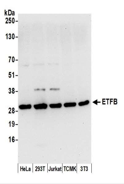 Anti-ETFB