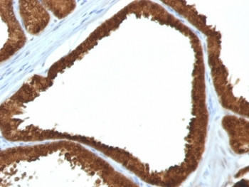 Anti-IDH1 / Isocitrate Dehydrogenase, clone IDH1/1152