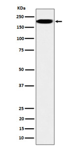 Anti-IQGAP2 / IQ motif containing GTPase activating protein 2, clone 30I08