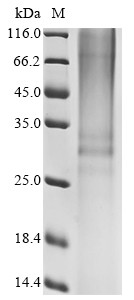 Non-secretory ribonuclease (RNASE2), human, recombinant