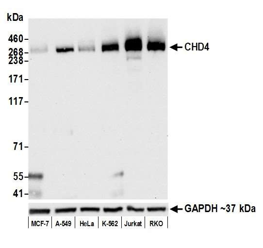 Anti-CHD4 Recombinant Rabbit Monoclonal