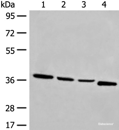 Anti-OTUD6A