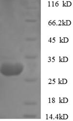 Cathepsin K (Ctsk), rabbit, recombinant